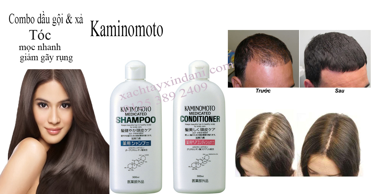 Tại sao bạn nên dùng combo dầu gội xả Kaminomoto để hạn chế tóc gãy rụng?